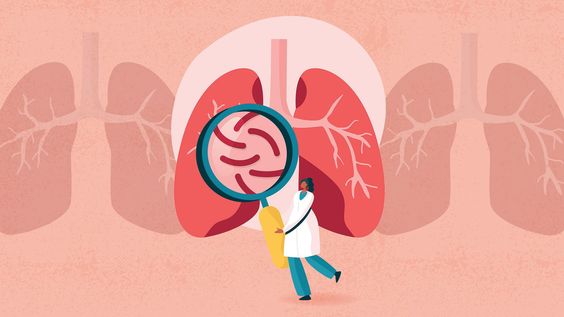 COPD: Symptoms, Treatment, and Management